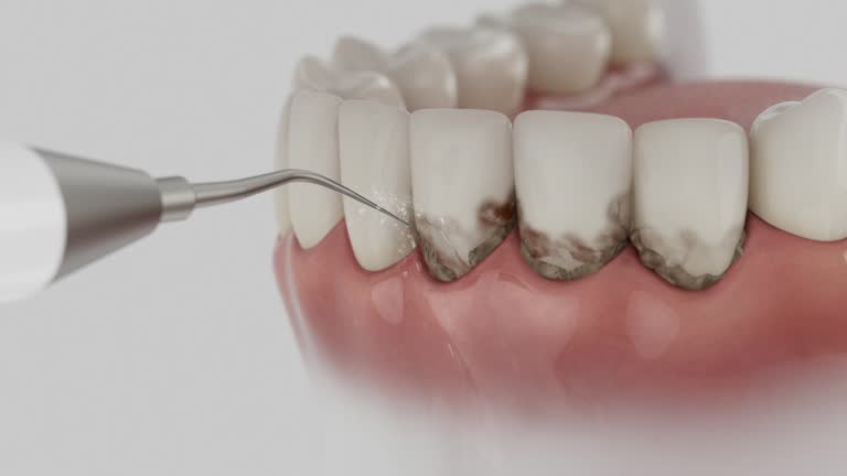 Trusted Dental Crowns And Bridges service in La Salle, CO - Dentist Open Now